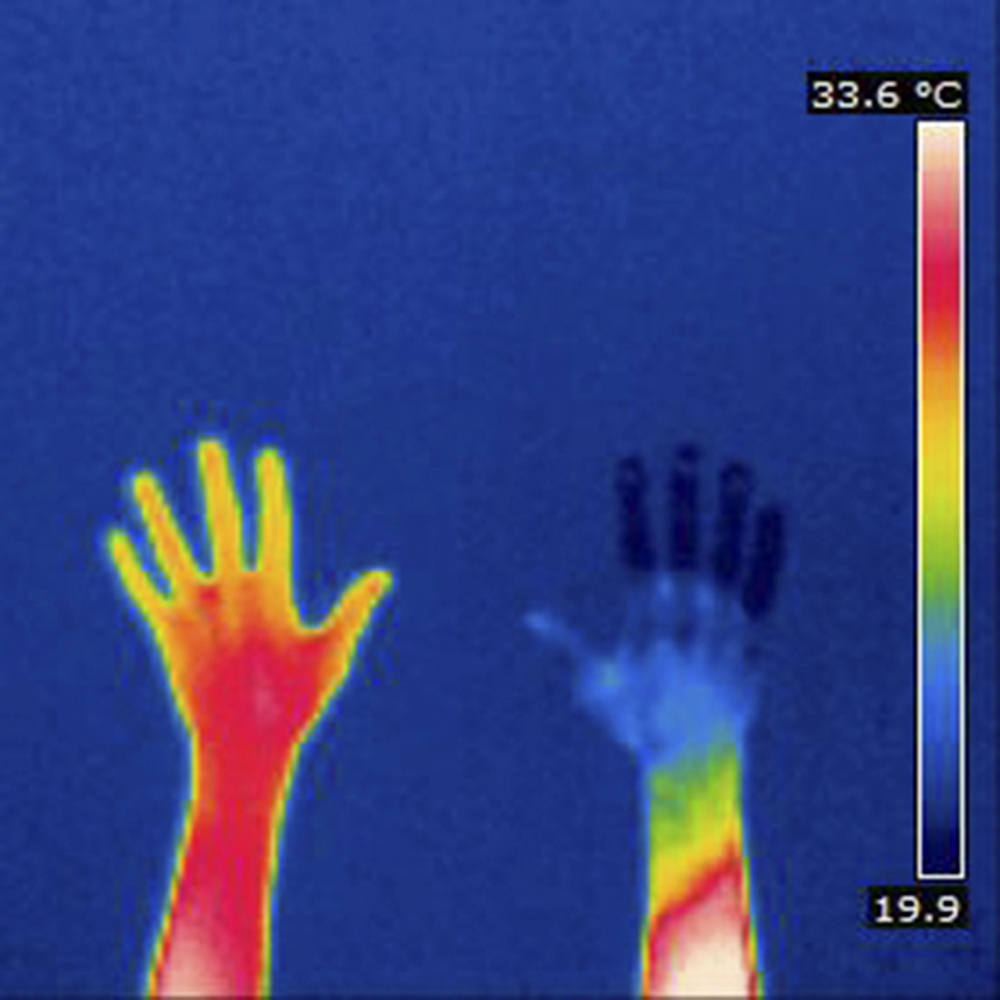 hands thermal scan